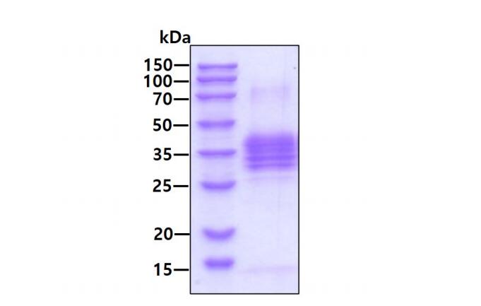 3 µg by SDS-PAGE under reducing condition and visualized by coomassie blue stain